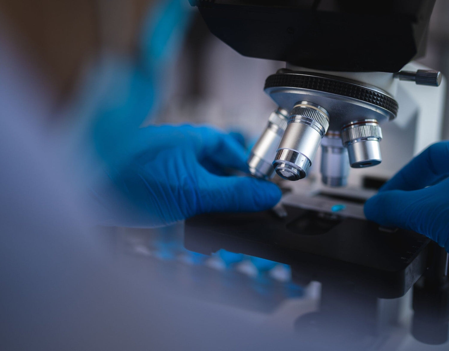 Uzroci gljivičnih infekcija: zašto se ponekad zalijepe baš na tebe